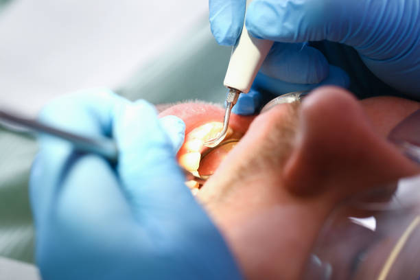 Best Urgent Care for Lost Fillings or Crowns in Dland, MI