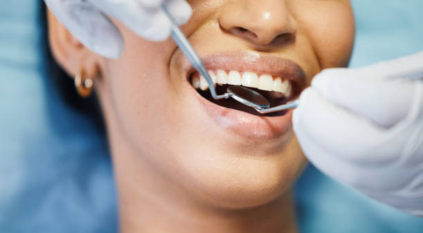 Best Same-Day Emergency Dental Services in Dland, MI